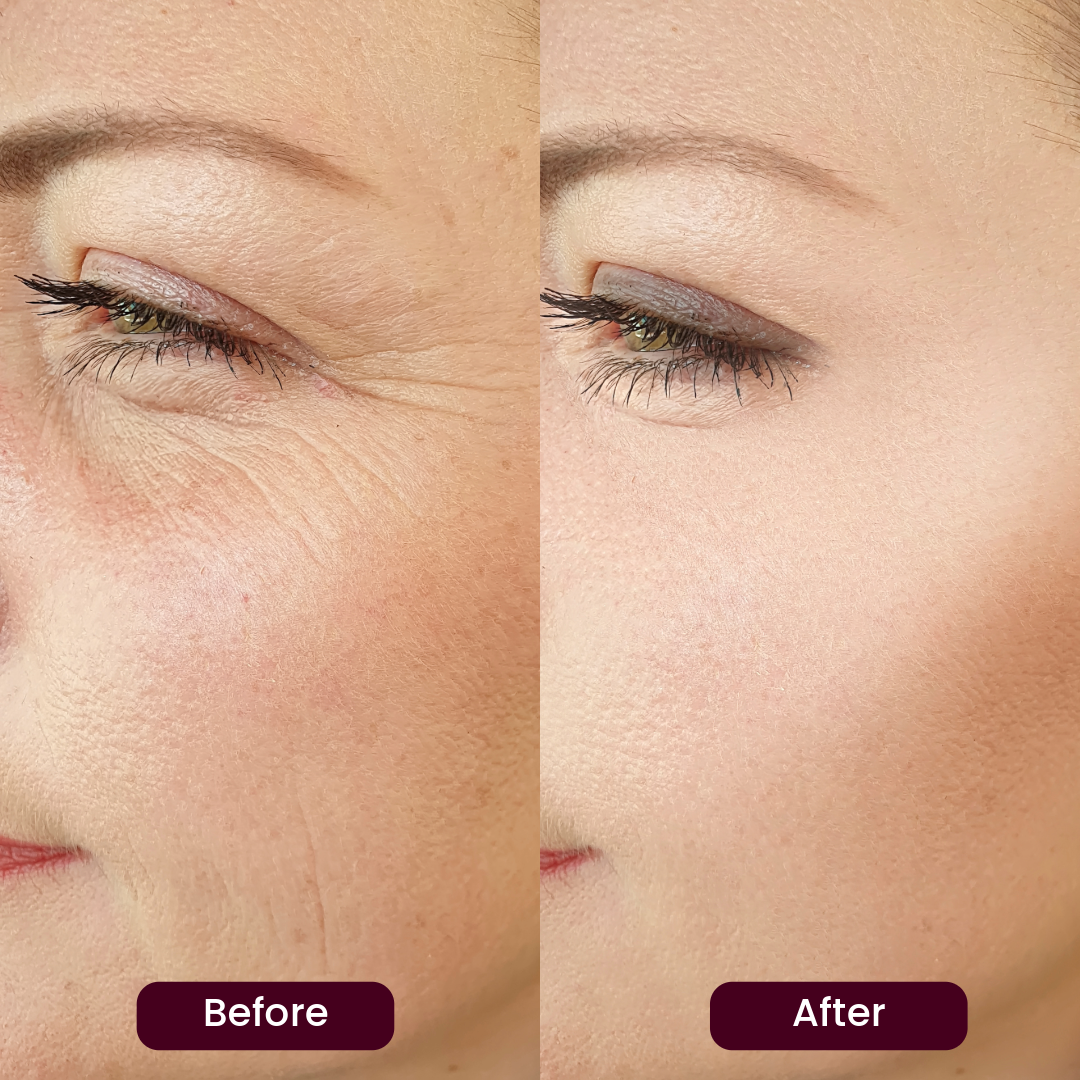 Vestrana 5 in 1 serum