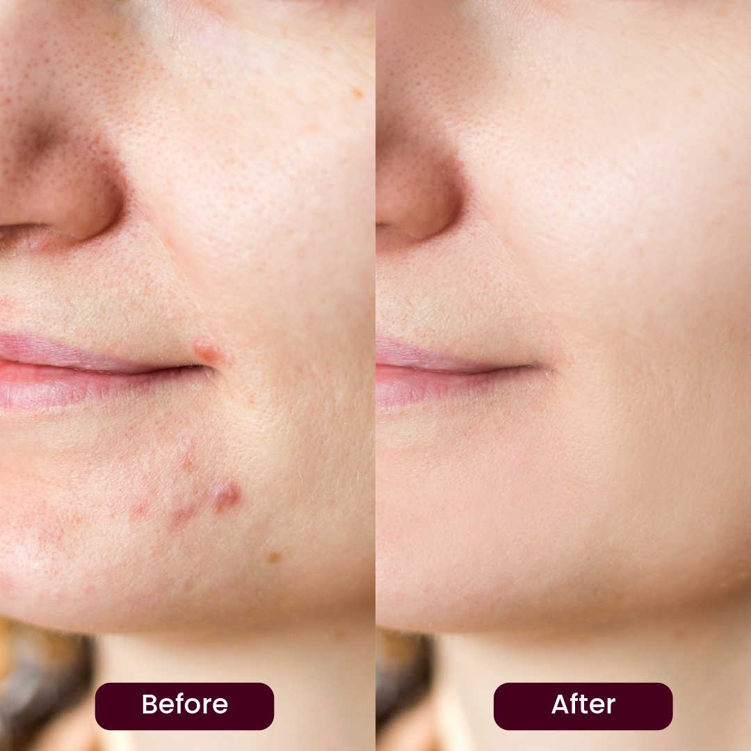 Vestrana 5 in 1 serum